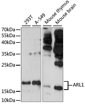 ARL1 Polyclonal Antibody (100 µl)