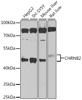 CHRNB2 Polyclonal Antibody (50 µl)