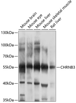 CHRNB3 Polyclonal Antibody (100 µl)