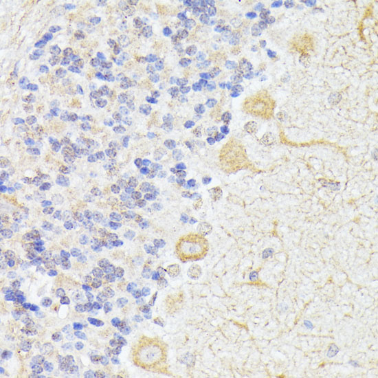 ELP3 Polyclonal Antibody (50 µl)