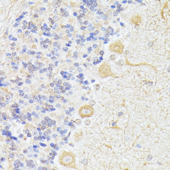 ELP3 Polyclonal Antibody (100 µl)