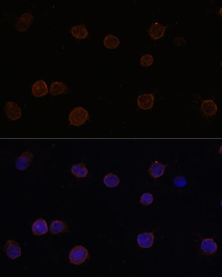 ANO2 Polyclonal Antibody (100 µl)