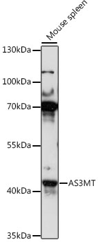 AS3MT Polyclonal Antibody (100 µl)