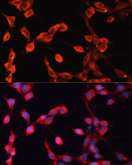 ADAMTS13 Polyclonal Antibody (50 µl)