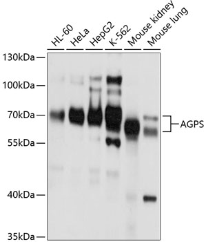 AGPS Polyclonal Antibody (100 µl)