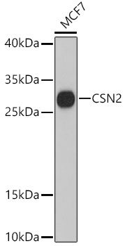CSN2 Polyclonal Antibody (100 µl)