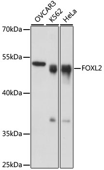 FOXL2 Polyclonal Antibody (50 µl)