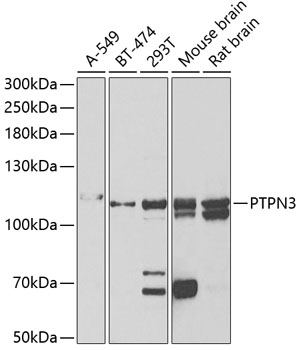 PTPN3 Polyclonal Antibody (100 µl)