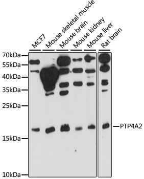 PTP4A2 Polyclonal Antibody (50 µl)