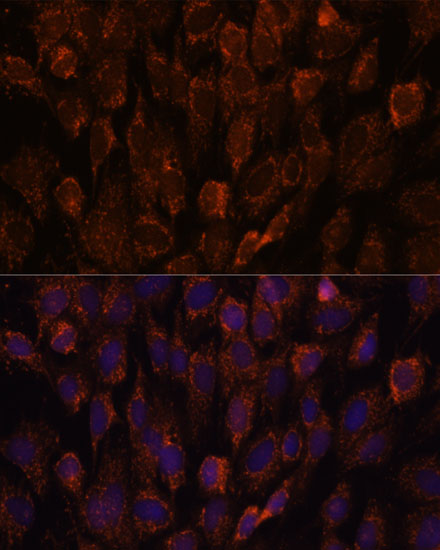 NSDHL Polyclonal Antibody
