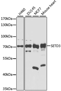 SETD3 Polyclonal Antibody (50 µl)