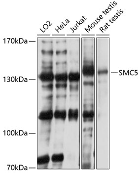 SMC5 Polyclonal Antibody (100 µl)