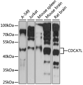 CDCA7L Polyclonal Antibody (100 µl)