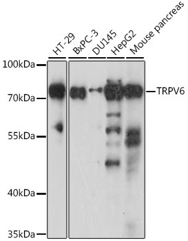 TRPV6 Polyclonal Antibody