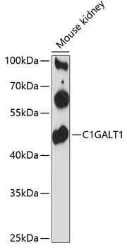 C1GALT1 Polyclonal Antibody (50 µl)