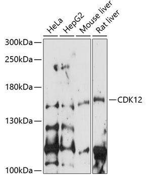 CDK12 Polyclonal Antibody (50 µl)