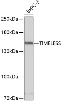TIMELESS Polyclonal Antibody (100 µl)