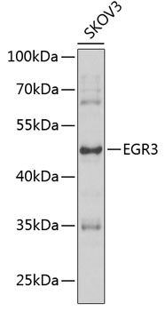 EGR3 Polyclonal Antibody (100 µl)