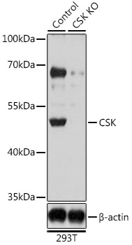 CSK Polyclonal Antibody (50 µl)