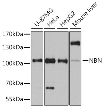 NBN Polyclonal Antibody (100 µl)