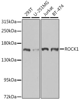 ROCK1 Polyclonal Antibody (100 µl)