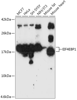 EIF4EBP1 Polyclonal Antibody (50 µl)