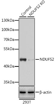 NDUFS2 Polyclonal Antibody (100 µl)
