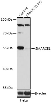 SMARCE1 Polyclonal Antibody (100 µl)