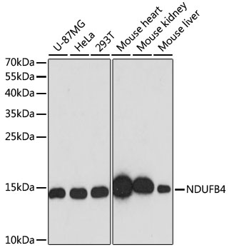 NDUFB4 Polyclonal Antibody (100 µl)