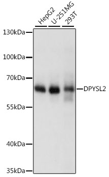 DPYSL2 Polyclonal Antibody (100 µl)