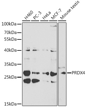 PRDX4 Polyclonal Antibody