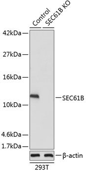 SEC61B Polyclonal Antibody (100 µl)