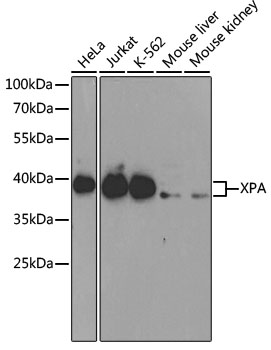 XPA Polyclonal Antibody (50 µl)