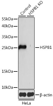 HSPB1 Polyclonal Antibody (100 µl)