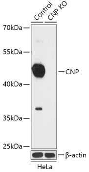 CNP Polyclonal Antibody (100 µl)