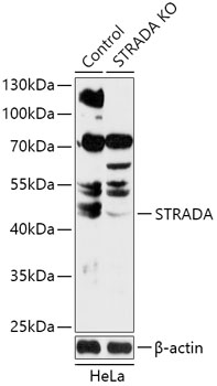 STRADA Polyclonal Antibody (50 µl)