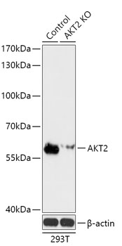AKT2 Polyclonal Antibody (100 µl)