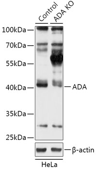 ADA Polyclonal Antibody (50 µl)