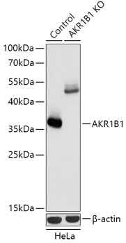 AKR1B1 Polyclonal Antibody (100 µl)