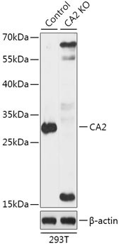 CA2 Polyclonal Antibody (100 µl)
