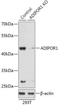 ADIPOR1 Polyclonal Antibody (100 µl)