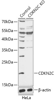 CDKN2C Polyclonal Antibody (100 µl)