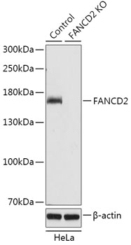 FANCD2 Polyclonal Antibody (50 µl)