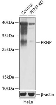 PRNP Polyclonal Antibody
