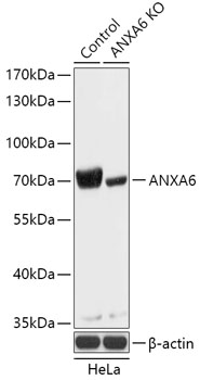 ANXA6 Polyclonal Antibody (50 µl)