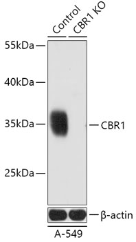 CBR1 Polyclonal Antibody (50 µl)