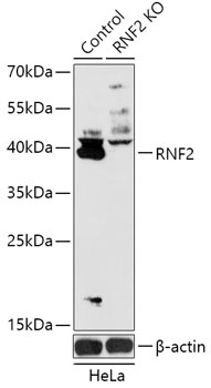 RNF2 Polyclonal Antibody (100 µl)