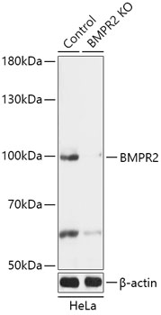 BMPR2 Polyclonal Antibody (100 µl)