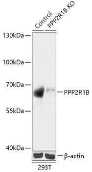 PPP2R1B Polyclonal Antibody (50 µl)