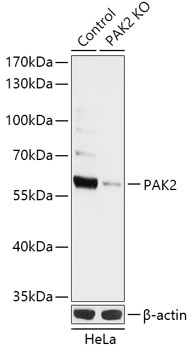 PAK2 Polyclonal Antibody (50 µl)